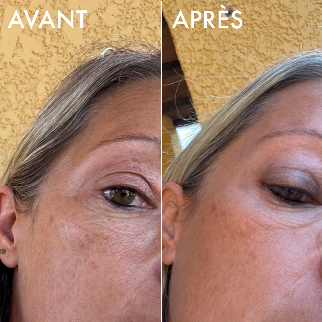 Avant-après du sérum éclat Voile Lacté sur une peau mature