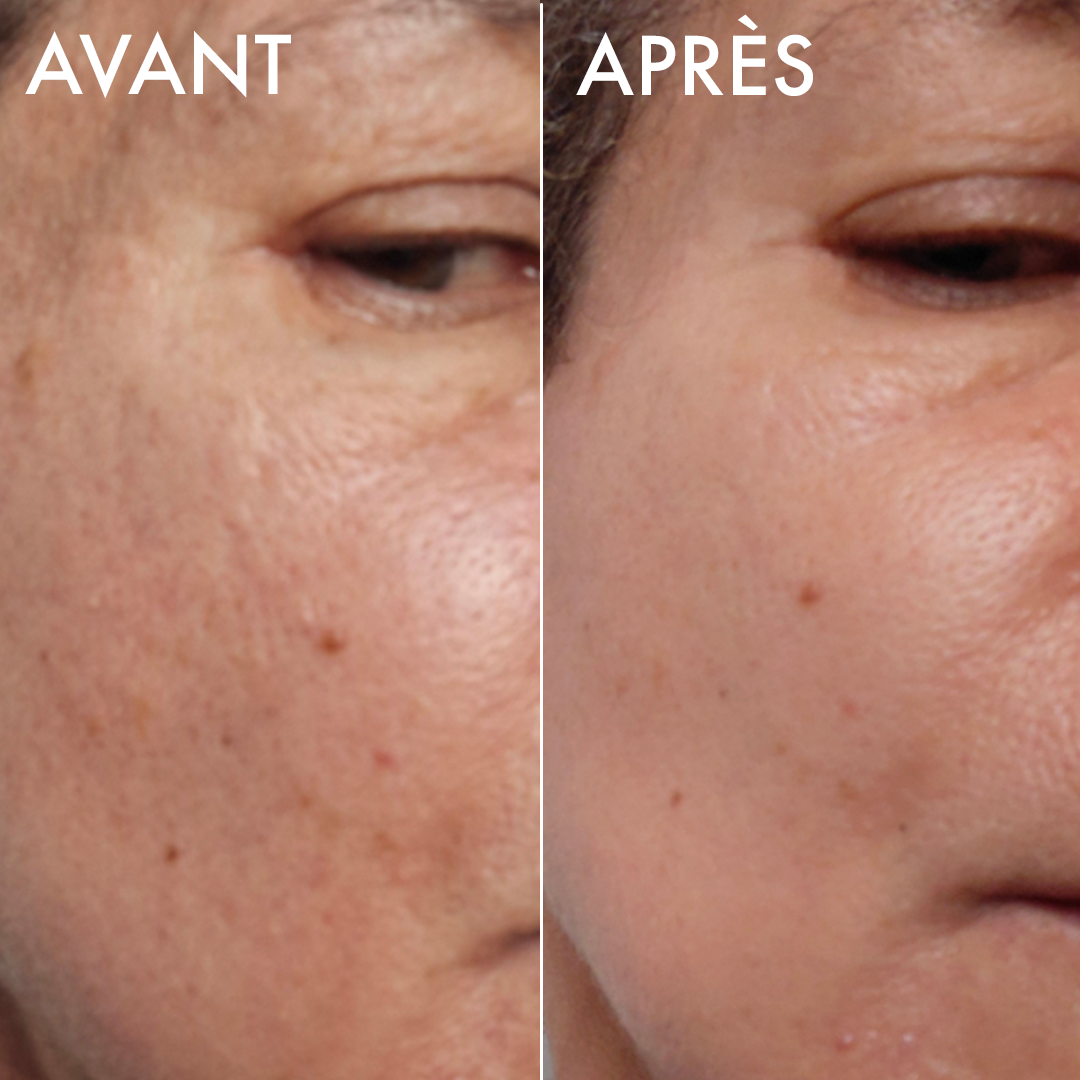 Avant-après du sérum éclat Voile Lacté sur une peau mature