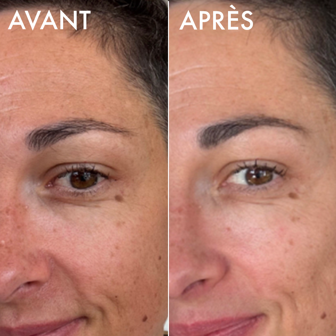Avant-après du sérum éclat Voile Lacté sur une peau mature